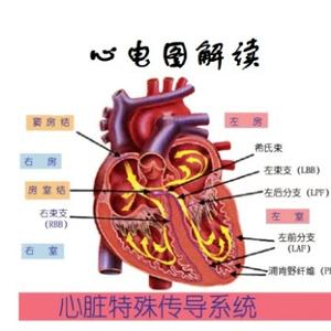 心电图解读头像